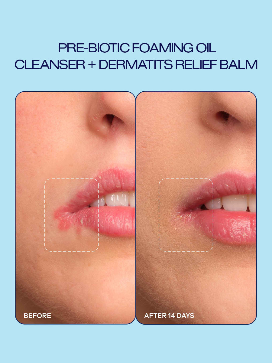 Prebiotic Skin Care