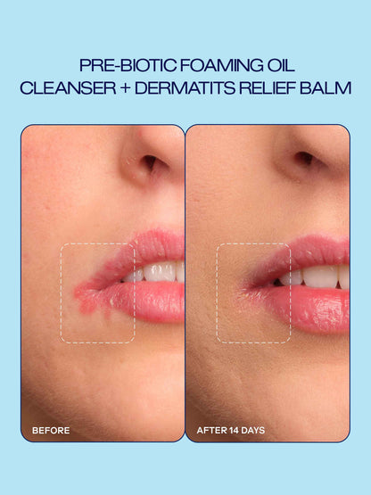 Prebiotic Skin Care