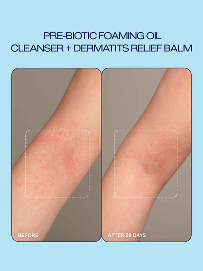Prebiotic Skin Care